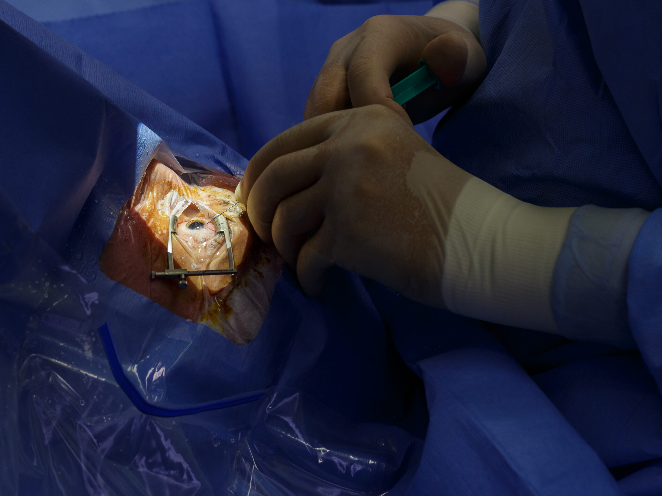 Institut für Augenheilkunde Halle